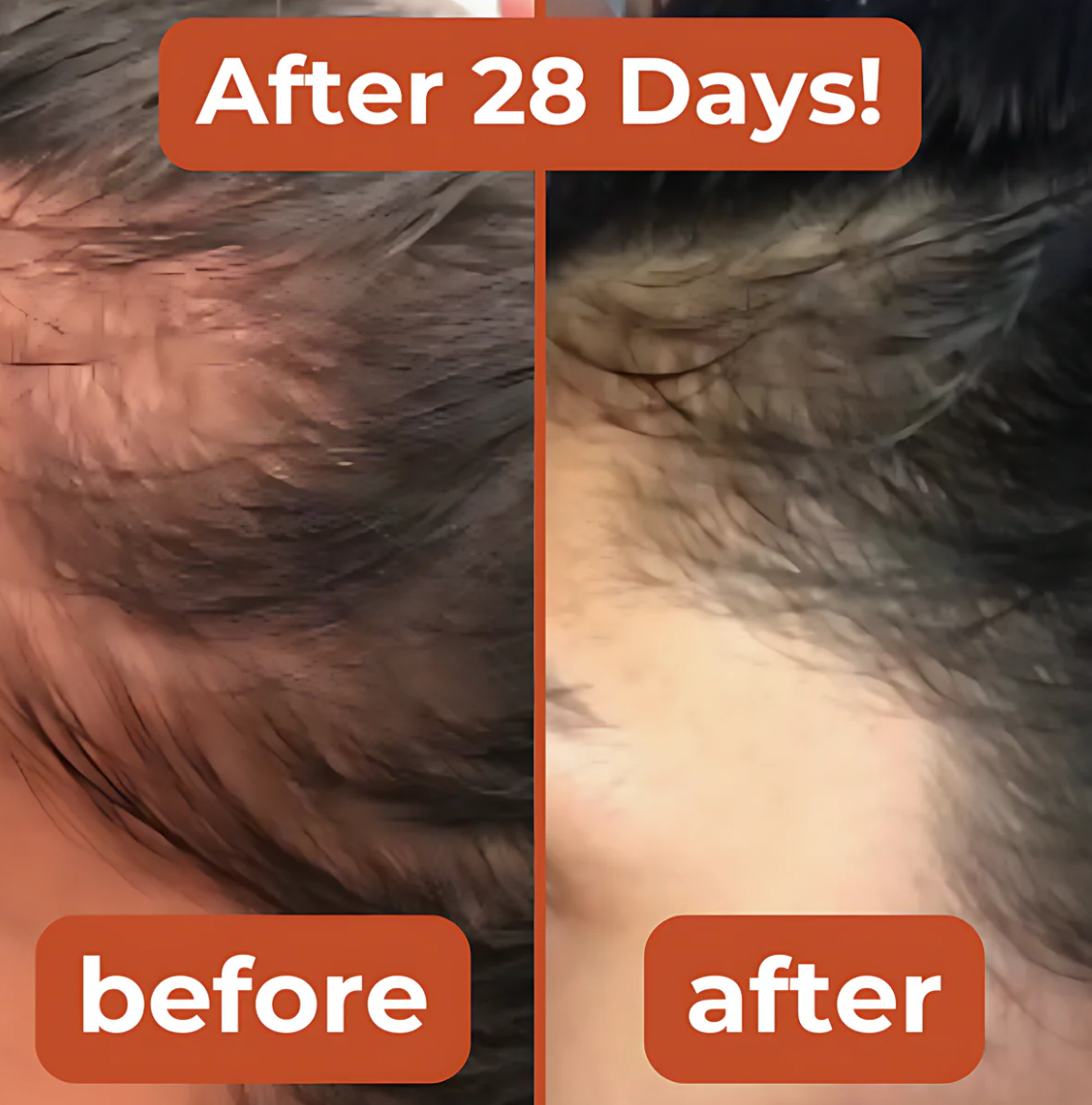 Zepkin™ Pumpkin Seed Oil Capsules