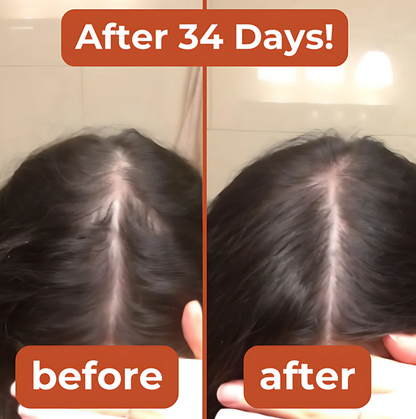 Zepkin™ Pumpkin Seed Oil Capsules