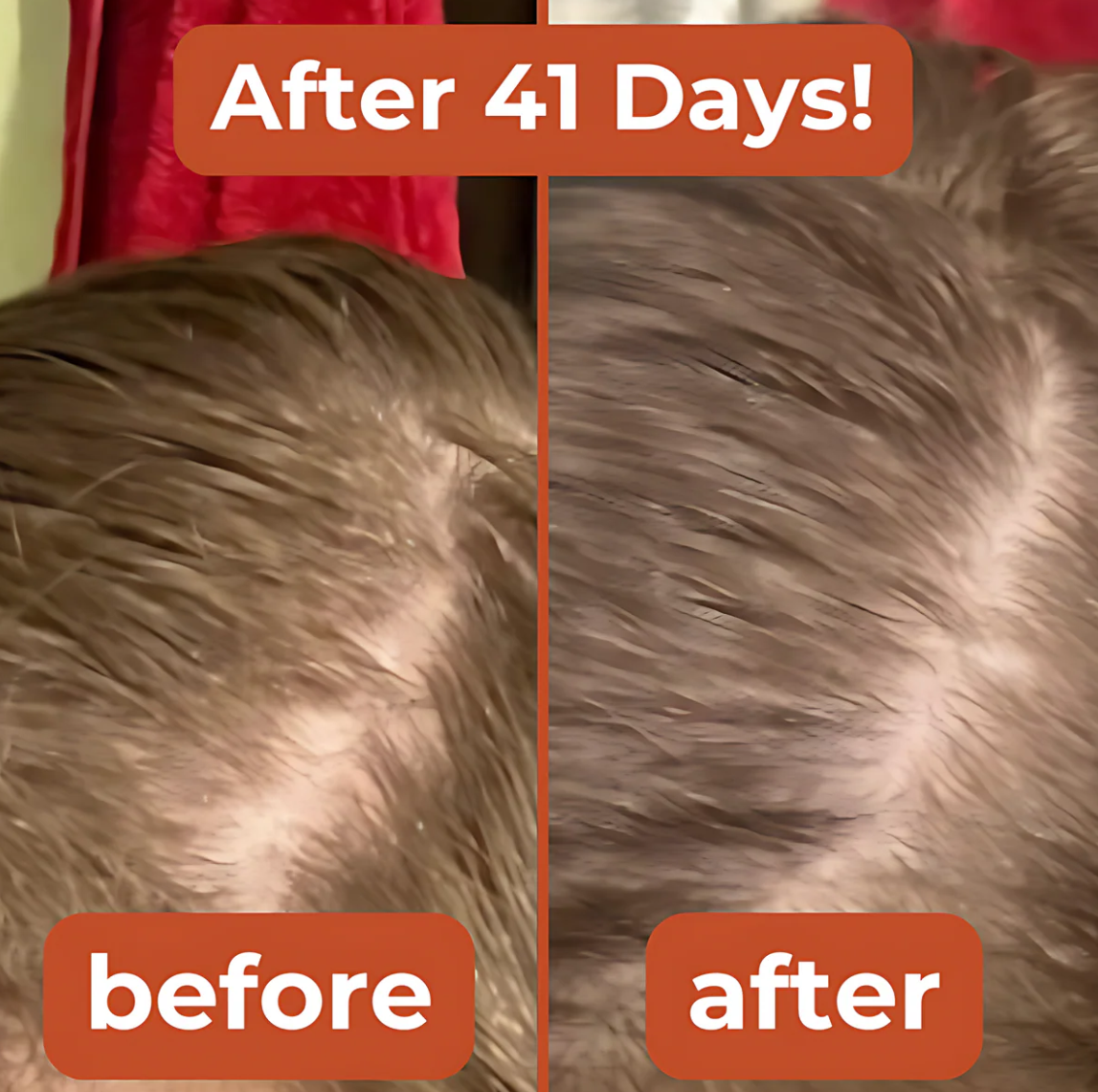 Zepkin™ Pumpkin Seed Oil Capsules