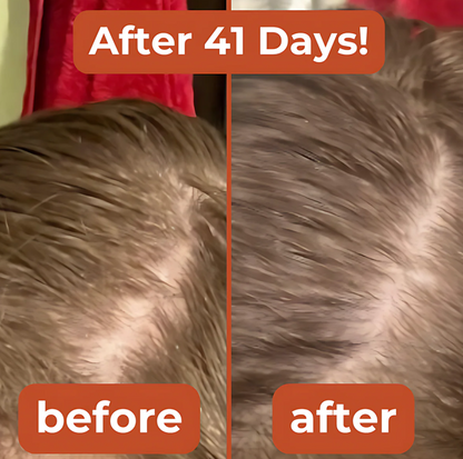 Zepkin™ Pumpkin Seed Oil Capsules